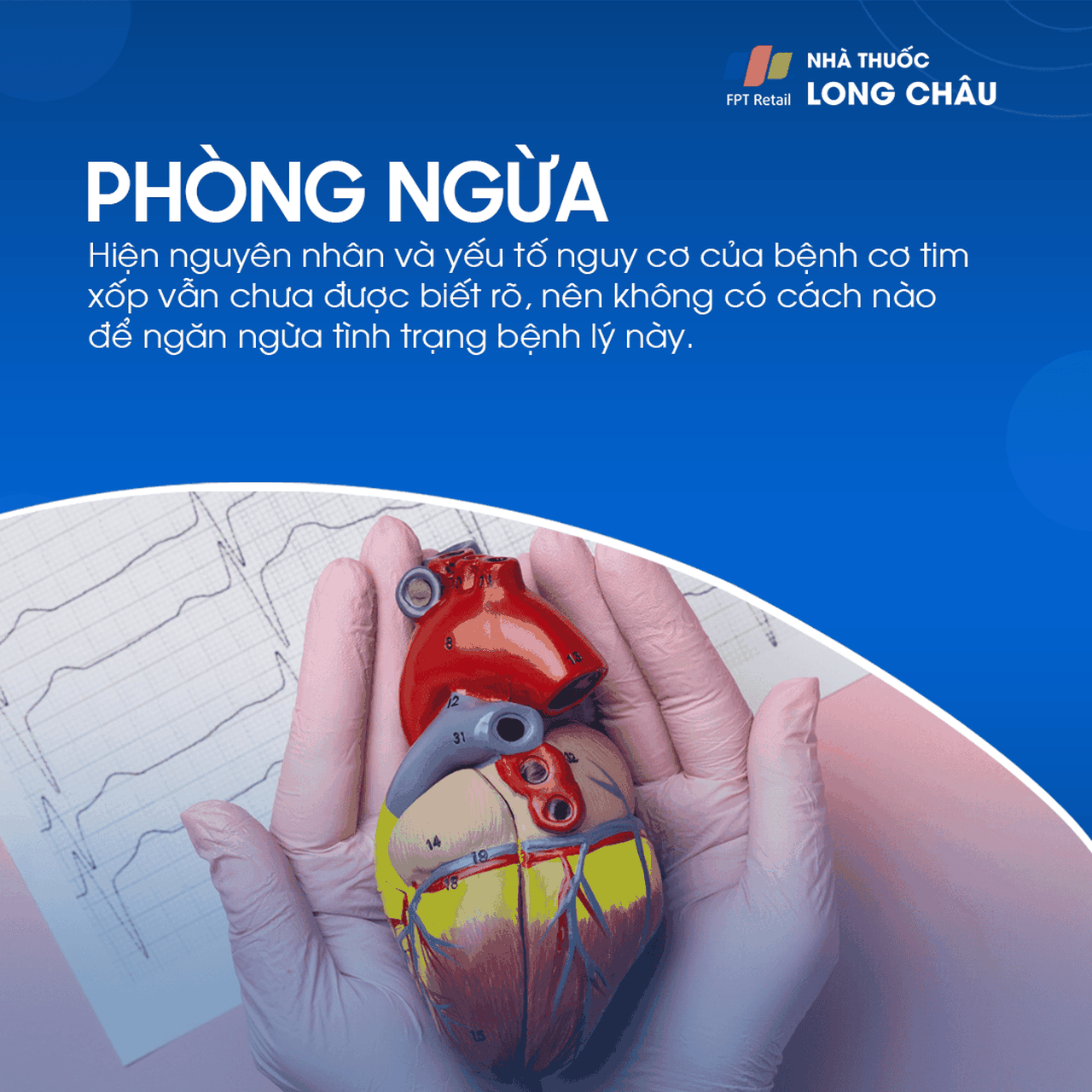 Hình ảnh minh họa cơ tim không đặc hiệu
