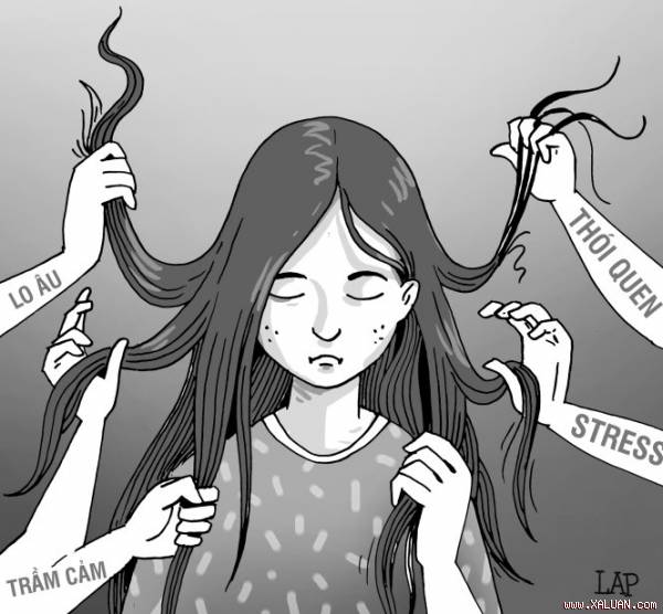 Trichotillomania - Nhổ tóc cưỡng bức