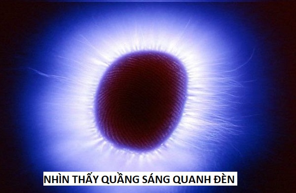 Nhìn Thấy Vầng Hào Quang Quanh Nguồn Sáng: Hiện Tượng, Nguyên Nhân và Cảnh Báo Y Khoa 7 Nhìn thấy quầng sáng quanh đèn