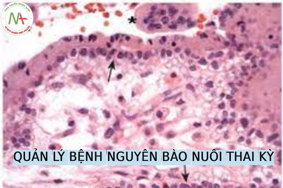 Biểu đồ theo dõi hCG sau điều trị