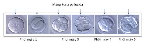 Quy trình phát triển phôi trong IVF