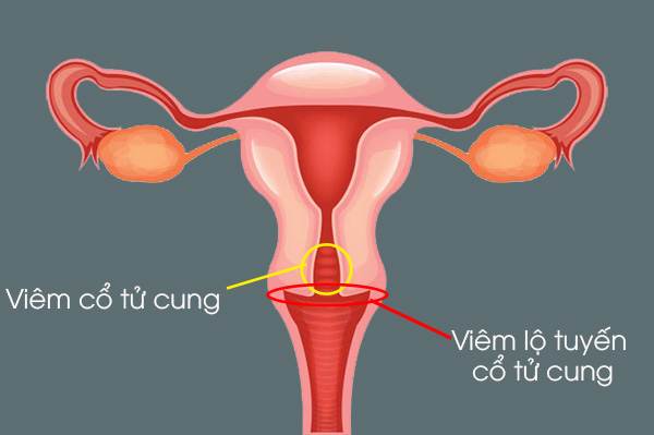 Dịch nhầy cổ tử cung và khả năng sinh sản