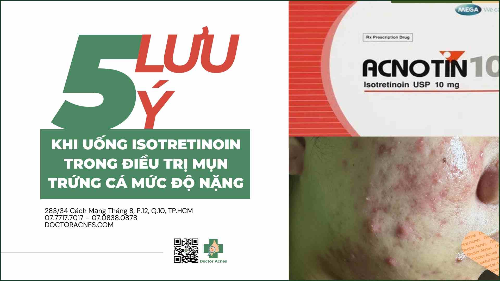 Thuốc Isotretinoin dạng viên