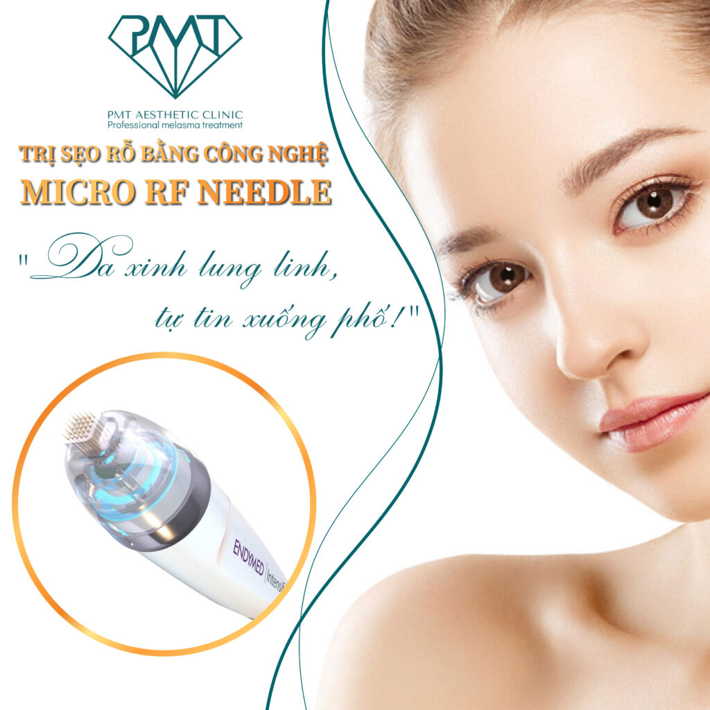 RF điều trị sẹo rỗ