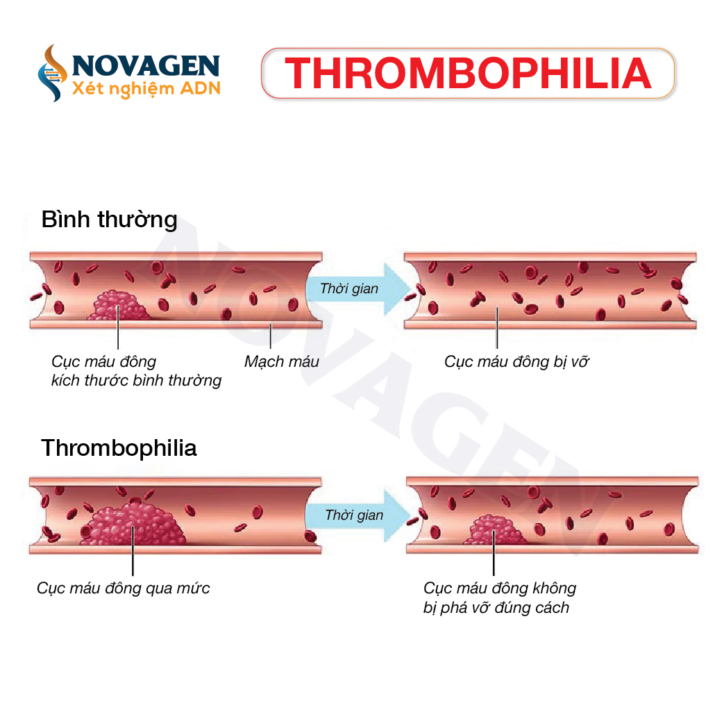 Thrombophilia là gì?