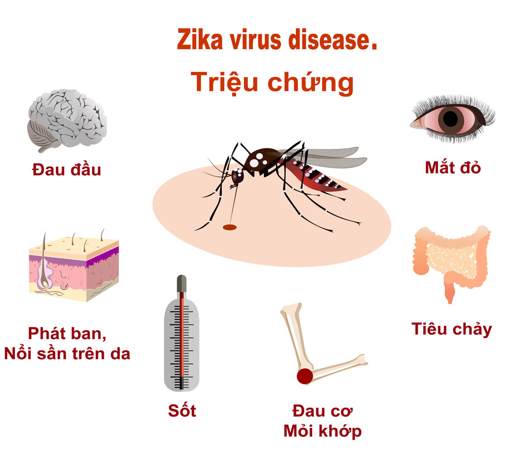 Triệu chứng virus Zika