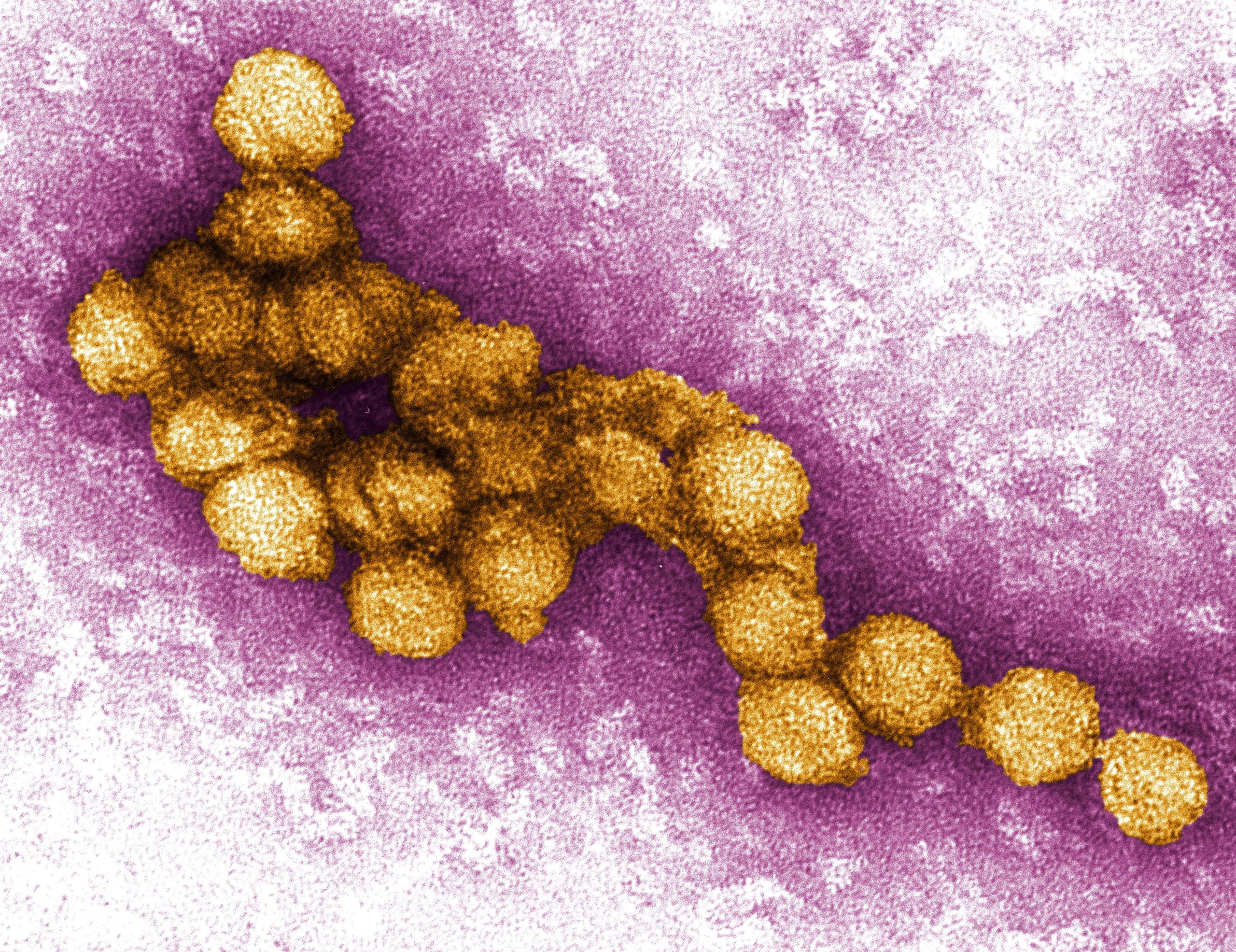 Virus Tây Sông Nile