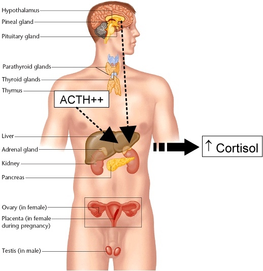 Xét nghiệm định lượng ACTH