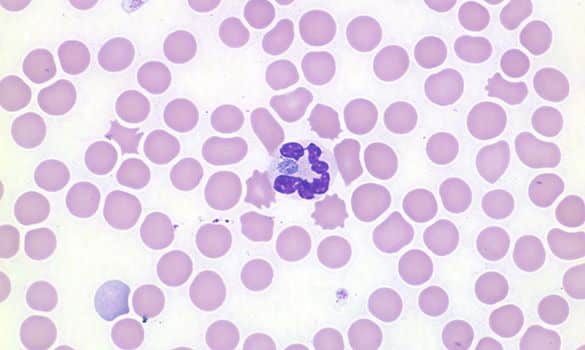 Chó mắc bệnh Anaplasmosis