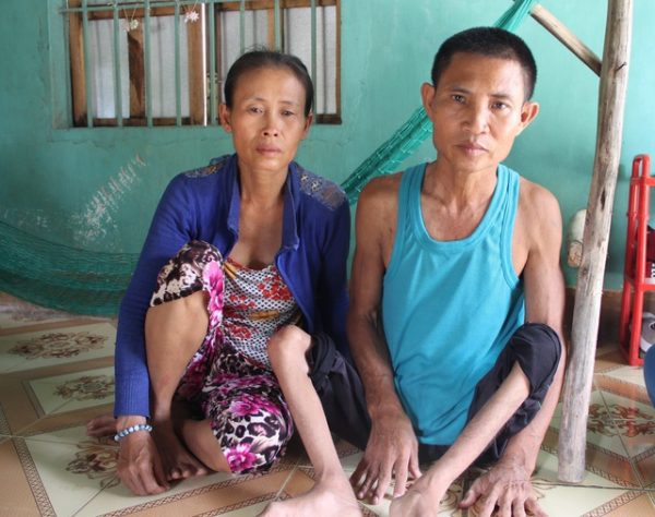 Người bệnh phục hồi chức năng sau bại liệt