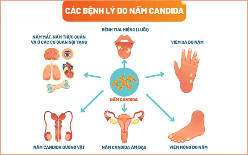 Nhiễm nấm Candida xâm lấn: Dấu hiệu, nguyên nhân và cách điều trị hiệu quả 7 Cấu trúc nấm Candida albicans