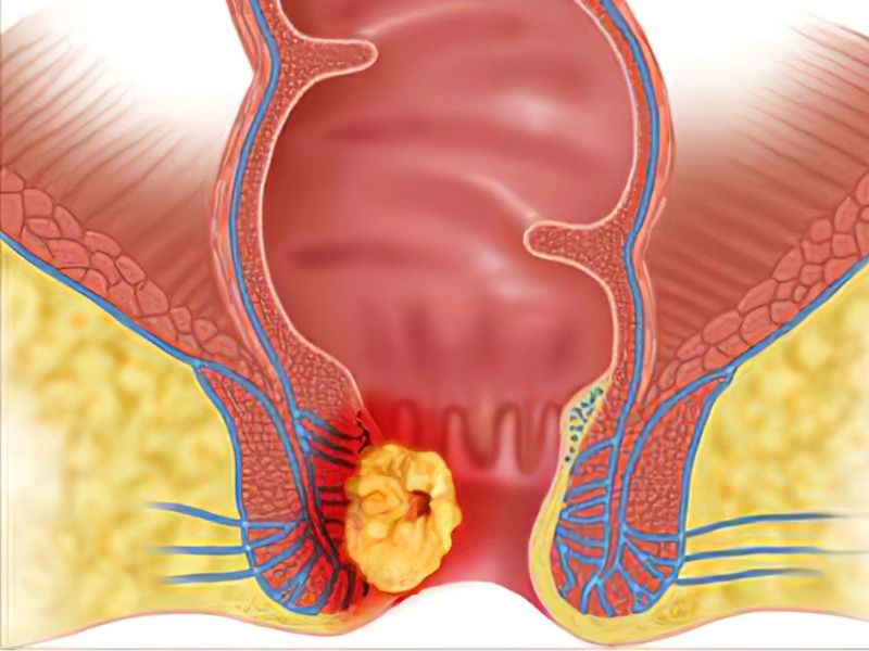 Cấu trúc âm hộ