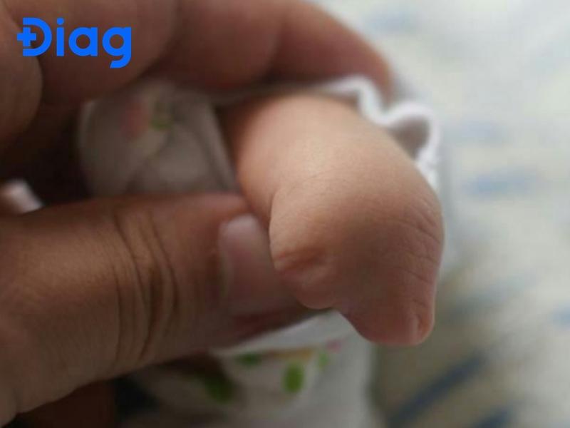 Quá trình lây nhiễm Toxoplasma