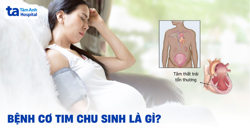 Phụ nữ sau sinh mệt mỏi do bệnh cơ tim chu sản