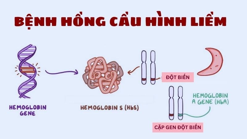 Phù thai Bart’s và nguy cơ tử vong cao