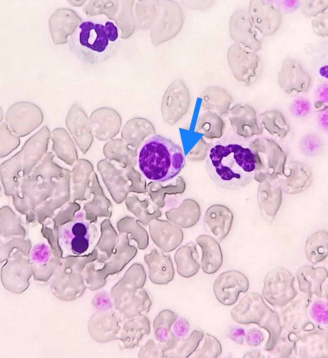 Triệu chứng Ehrlichiosis ở chó