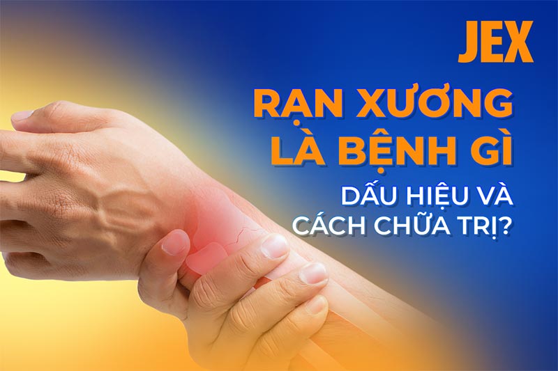 Rạn xương là gì? Triệu chứng, phân biệt và cách điều trị hiệu quả 8 Chẩn đoán rạn xương qua phim chụp