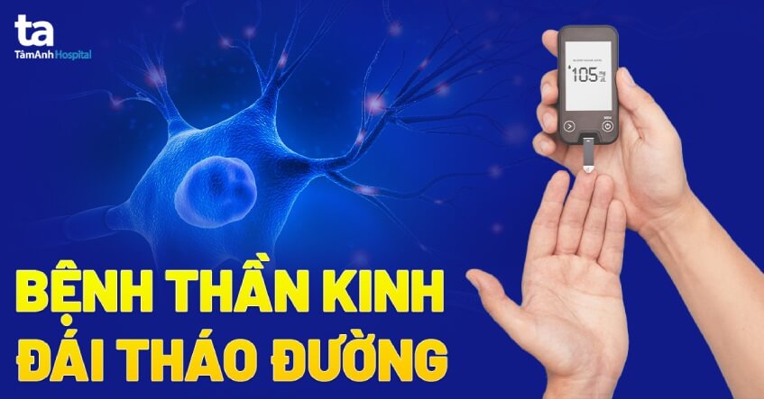 Triệu chứng của bệnh thần kinh do tiểu đường