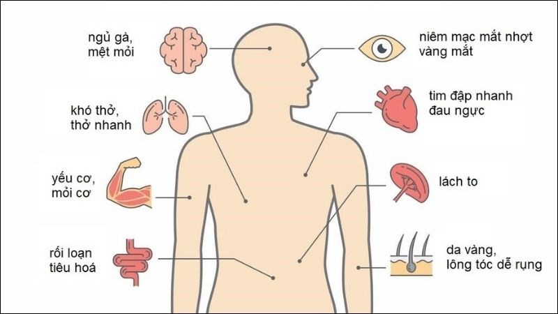 Thiếu máu tan máu