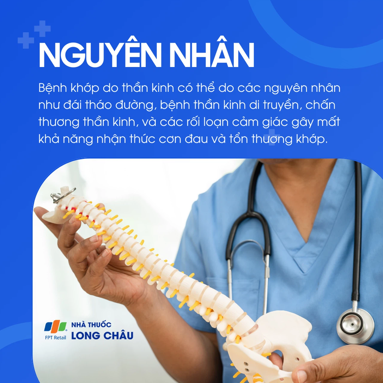 Nguyên nhân gây sai khớp