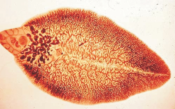 Bệnh sán lá gan lớn (Fascioliasis): Triệu chứng, nguyên nhân và cách điều trị 8 sán lá gan trong cơ thể