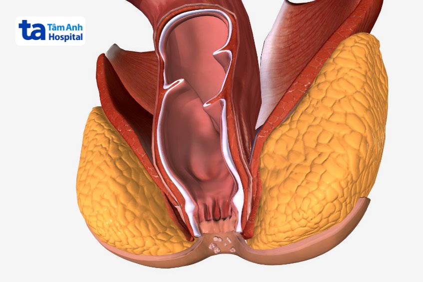 tổn thương xuyên cơ thắt hậu môn sau sinh