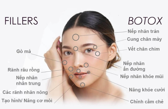 Botox và Filler là gì