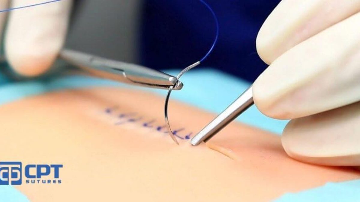 Hướng Dẫn Chăm Sóc Vết Thương Hở Sau Thẩm Mỹ Đúng Cách, Nhanh Lành & Không Để Lại Sẹo 7 vết thương thẩm mỹ chưa lành