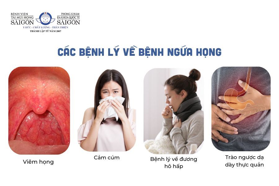 Ngứa Họng Là Gì? Nguyên Nhân, Triệu Chứng & Cách Điều Trị Hiệu Quả 8 nguyên nhân ngứa họng