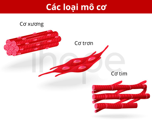 Sự hiện diện của sợi đỏ rách trong mô cơ