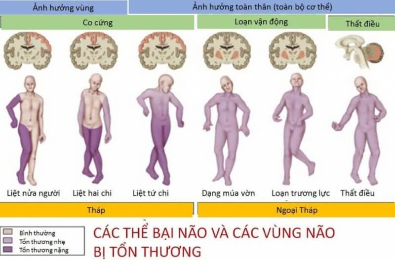 Các thể bại não