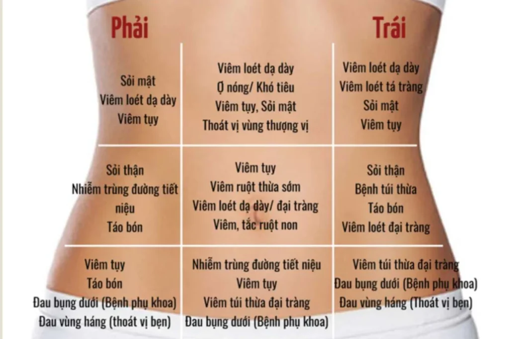 Bản đồ vị trí đau bụng