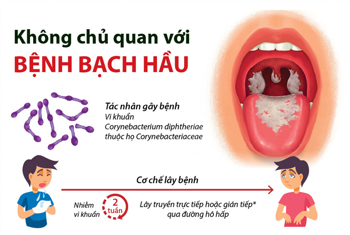 Cách thức lây nhiễm bệnh bạch hầu