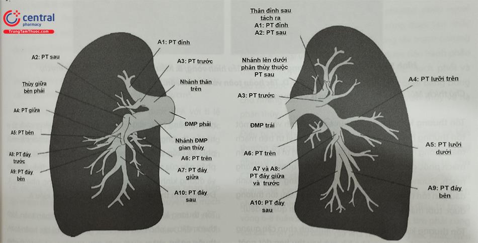 Can thiệp nong bóng điều trị tăng áp phổi