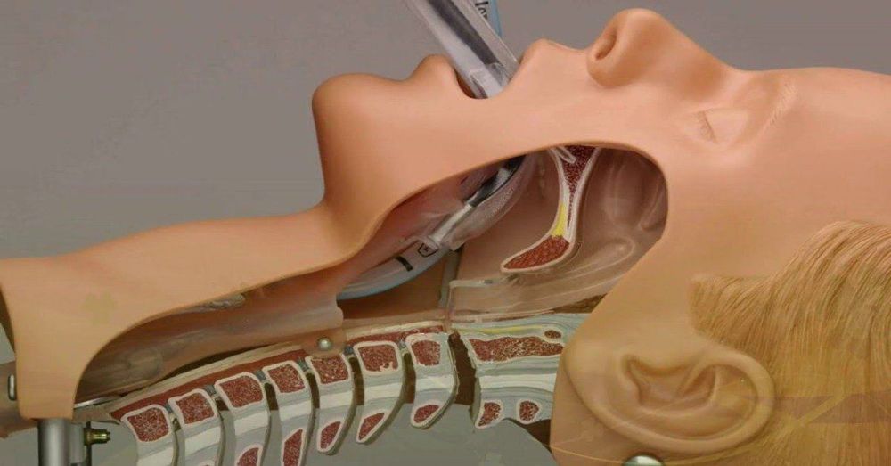 Chấn thương gây rách phế quản