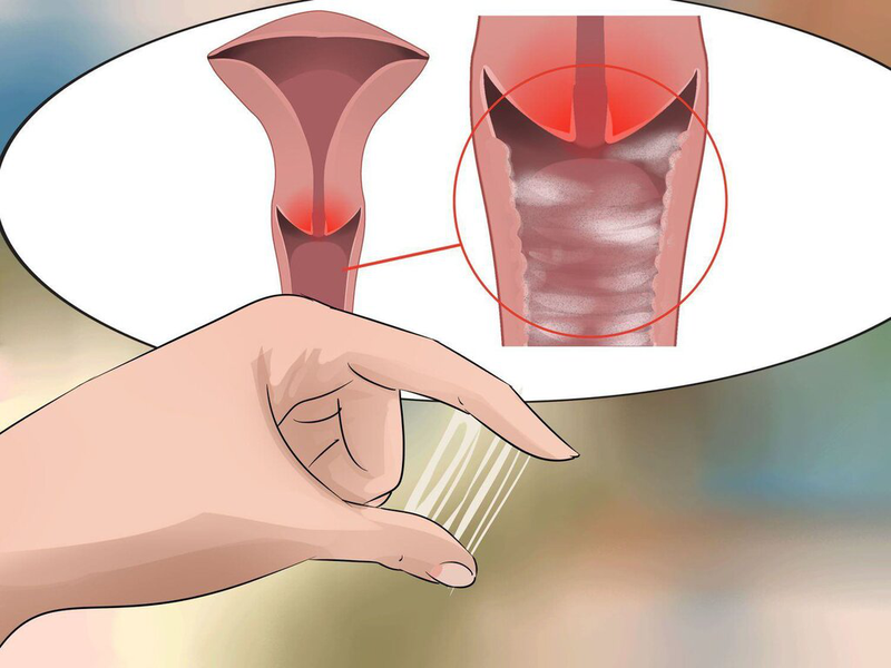 Chất nhầy không thuận lợi