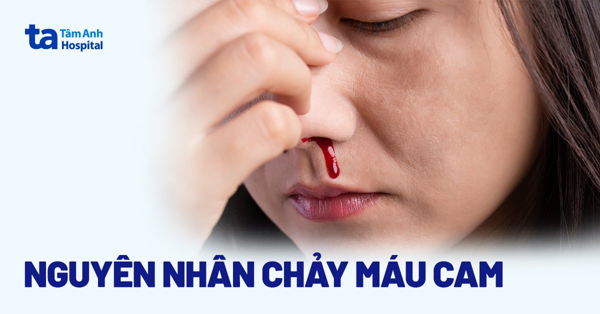 Chảy máu cam là gì