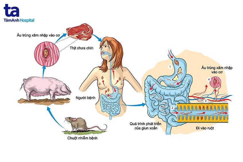 Bệnh Giun Xoắn: Nguyên Nhân, Triệu Chứng, Chẩn Đoán và Điều Trị 7 chu kỳ phát triển giun xoắn