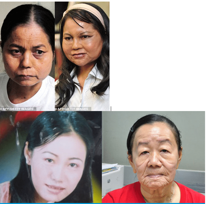 Hội chứng lão hóa sớm ở người trưởng thành