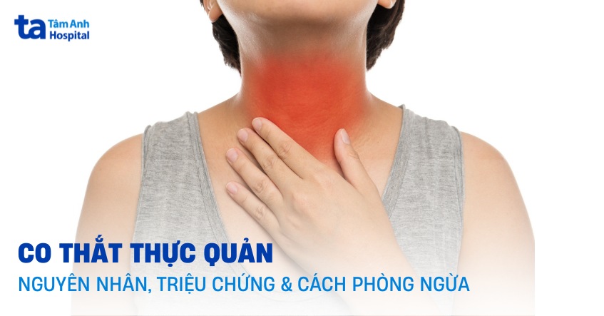 Co thắt cơ thực quản: Nguyên nhân, Triệu chứng và Cách điều trị 8 Chẩn đoán co thắt cơ thực quản