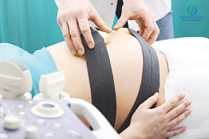Cơn co tử cung cường tính: Hiểu đúng để bảo vệ sức khỏe mẹ và bé 7 Cơn co tử cung cường tính