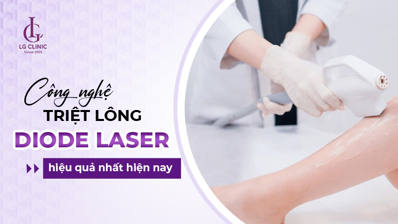 Công nghệ triệt lông Diode Laser