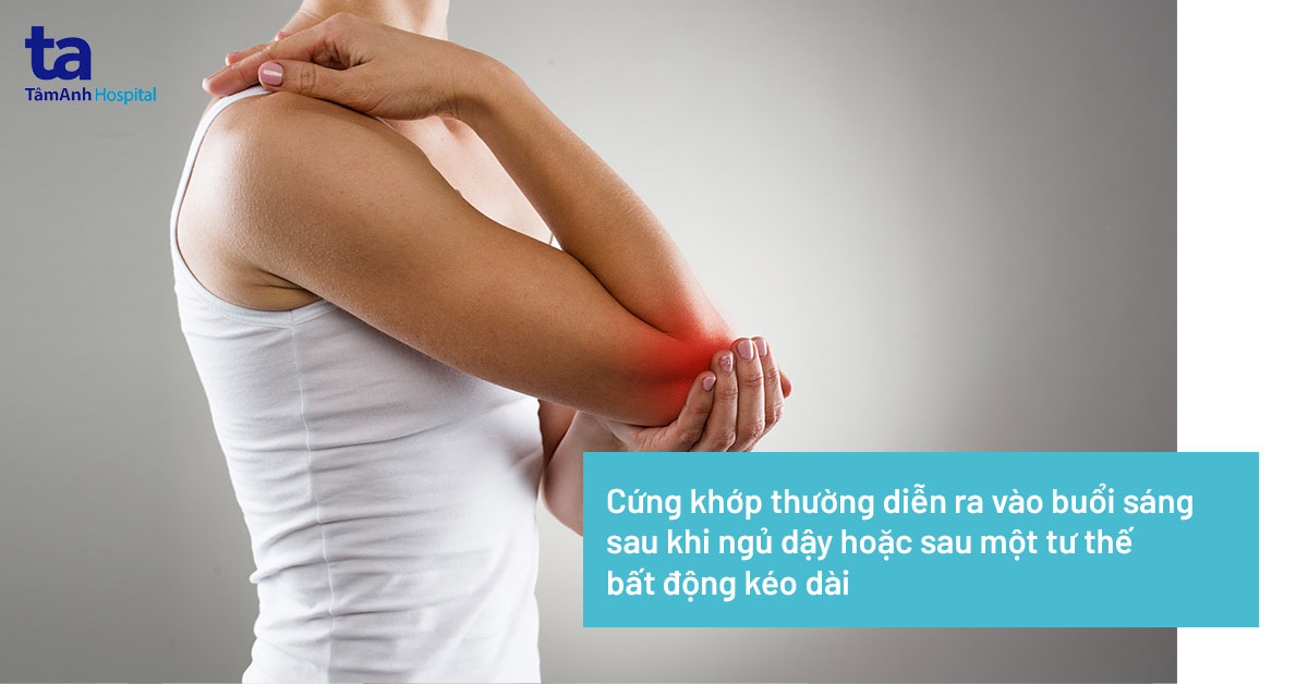 cứng khớp là gì