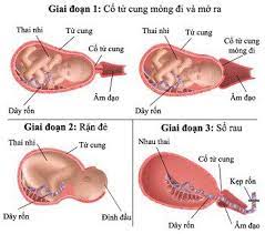 Cơn Co Tử Cung Yếu: Nguyên Nhân, Dấu Hiệu Và Xử Trí 7 chuyển dạ kéo dài
