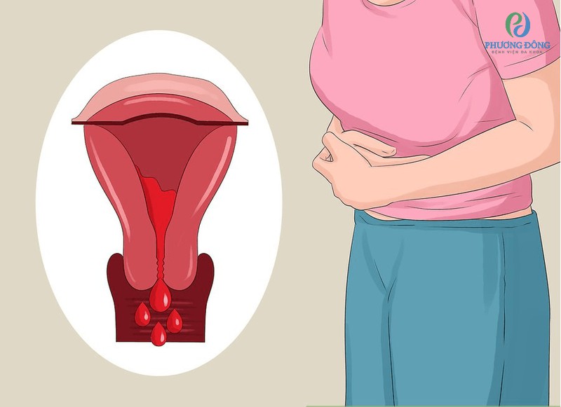 Cường kinh là gì?