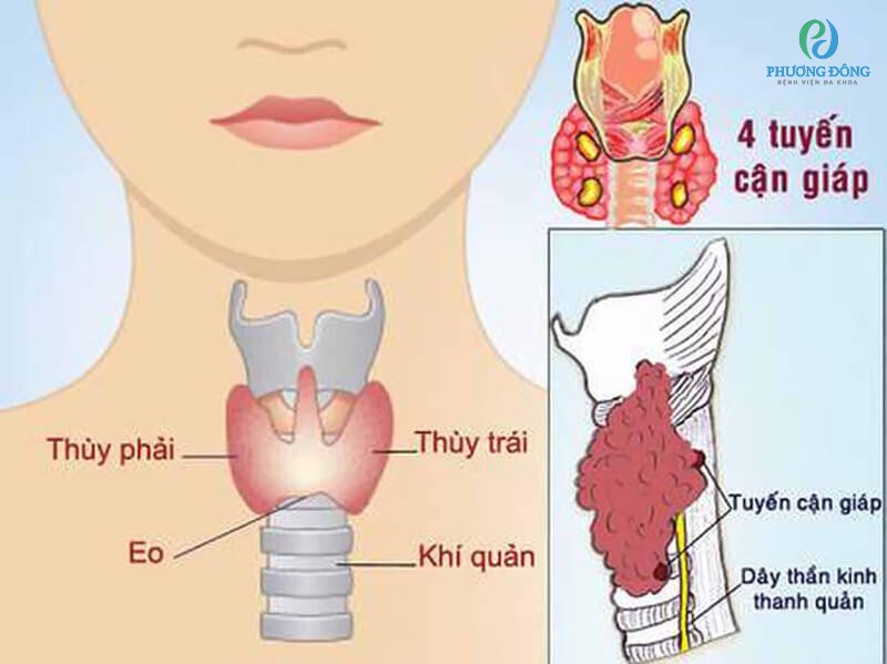 Bệnh tim do cường cận giáp và suy cận giáp: Những tác động thầm lặng đến hệ tim mạch 7 Tuyến cận giáp và ảnh hưởng đến tim