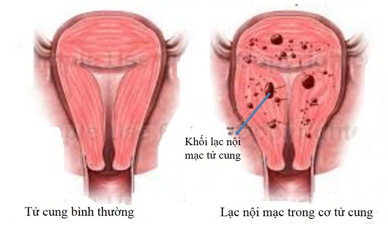 dau-bung-kinh.jpg