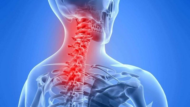 Đau Cổ Vai Gáy: Nguyên Nhân, Triệu Chứng và 7 Cách Điều Trị Hiệu Quả 7 Người bị đau cổ vai gáy khi làm việc sai tư thế