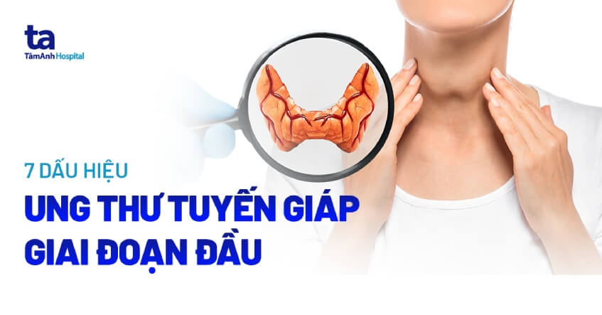 Dấu hiệu ung thư tuyến giáp