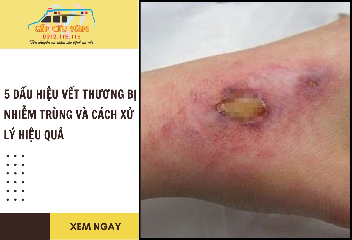 Hình ảnh vết thương nhiễm trùng
